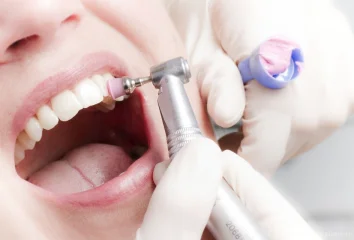 Гигиена зубов с выгодой 1 500 руб. Вторник и четверг скидка